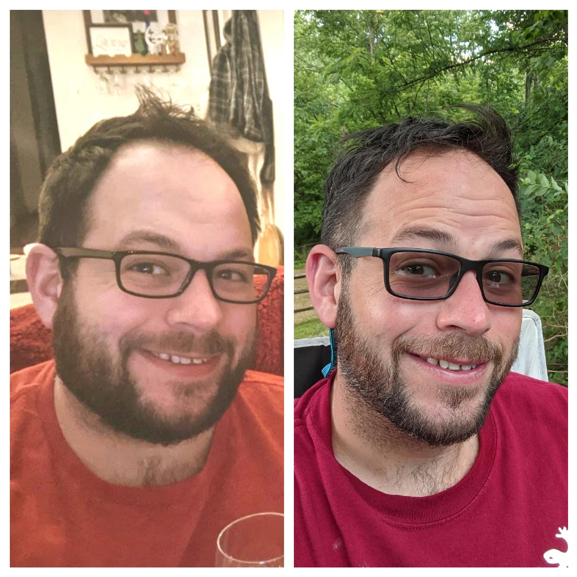 M3259 259 to 20158lbs 3.5 months Face gains Trying to keep the weight loss going now that Im back at work post-quarantine. Still dropped 5 lbs this week. Hiking with the campers is keeping me active